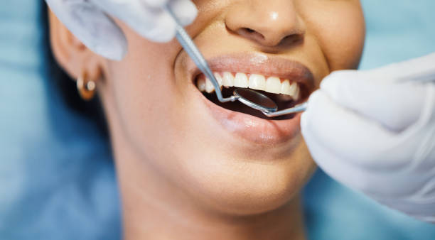 Best Emergency Dental Services for Seniors in Perry, FL