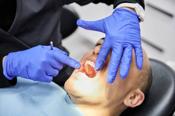 Emergency Dentist for Dental Implants