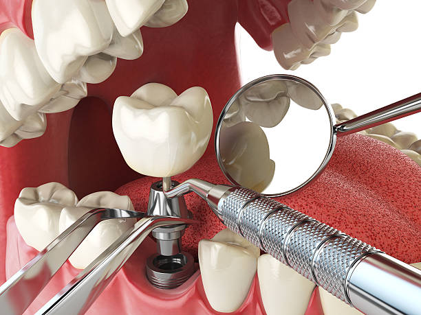 Best Emergency Cosmetic Dentistry in Perry, FL